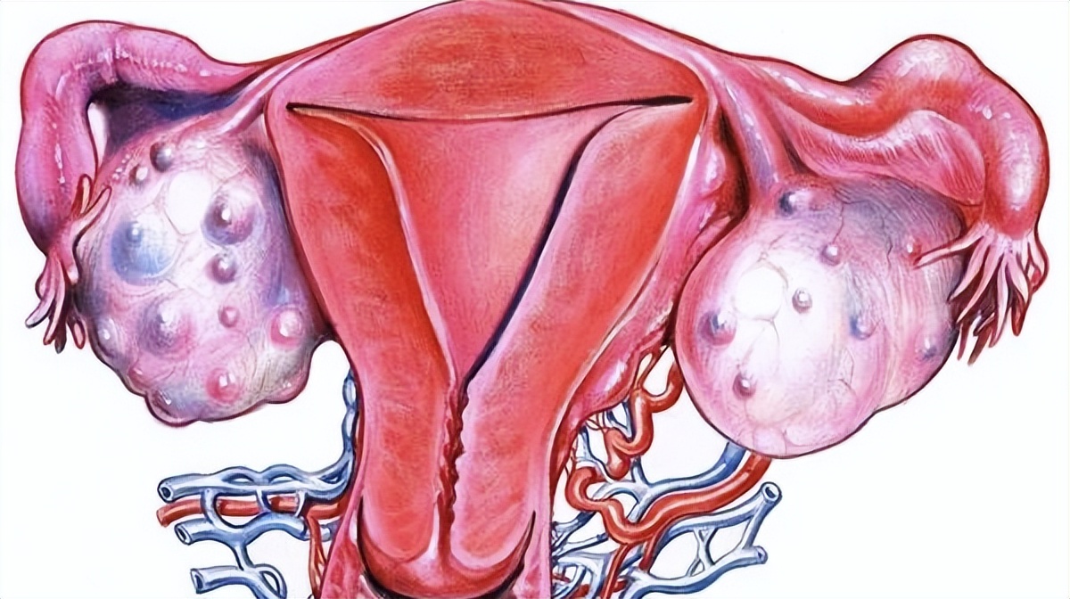 日本女人妇科病少的原因,为什么日本女人妇科病不多