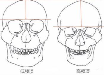 颅顶低发际线高怎么办,发际线高颅顶低怎么改善