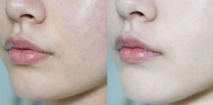 整个孕期都可以化妆吗,孕期可以用气垫吗