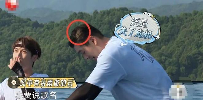 明星逃不过的脱发,明星也秃头还戴假发片