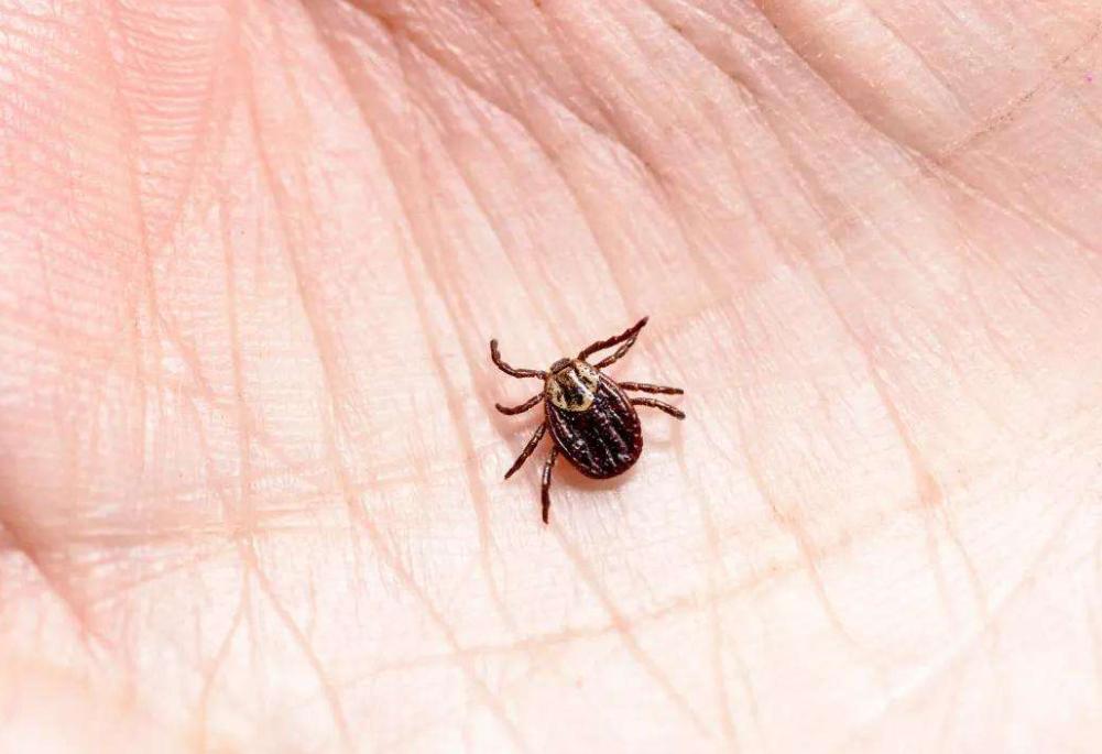 仓鼠咬人全身皮肤变成火龙果事件,杭州一女子买仓鼠得恙虫病