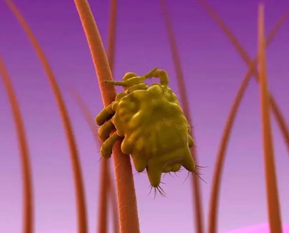 医生检查阴虱的镊子和刀片,男子发现阴虱