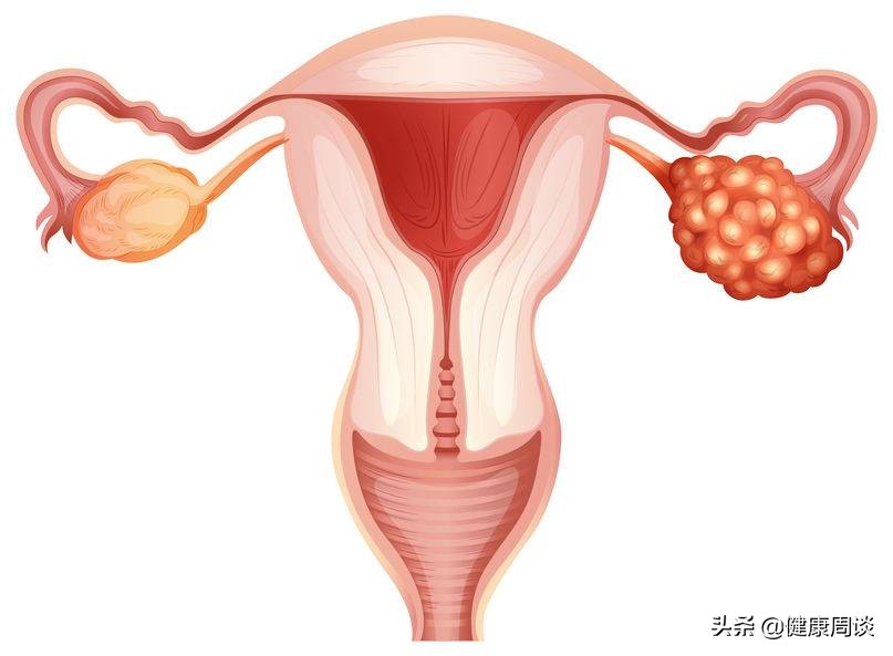 女性性激素失调怎么办,女性性激素紊乱