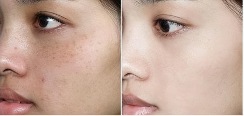 季草集祛斑护肤品28天祛斑管用吗,祛斑排行榜第一名口碑好的护肤品