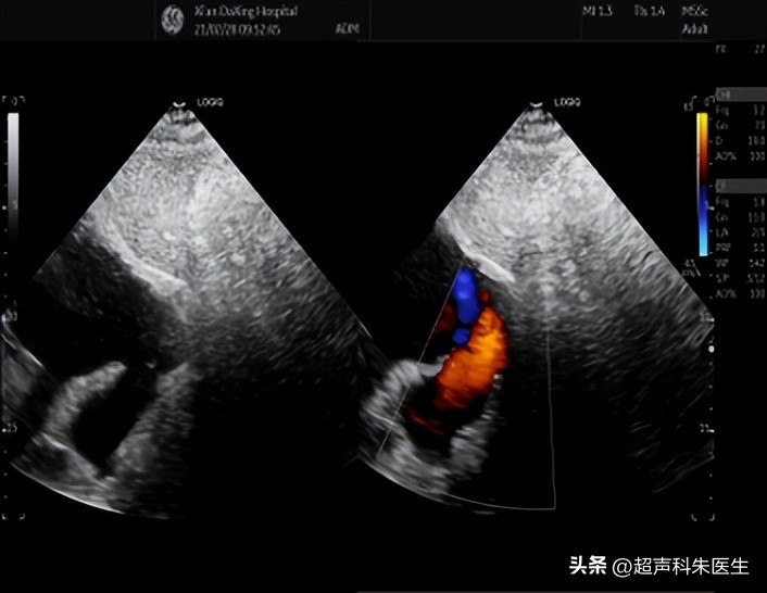 心眼多和心计是好事还是坏事,心眼多心不正