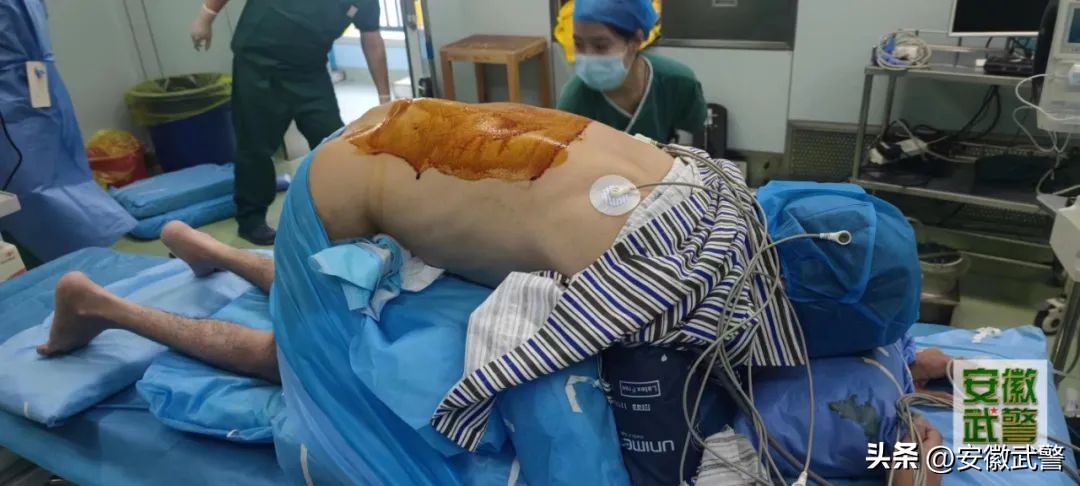 勇闯PCNL禁区——“*刀折**人”PCNL，勇敢者的较量！