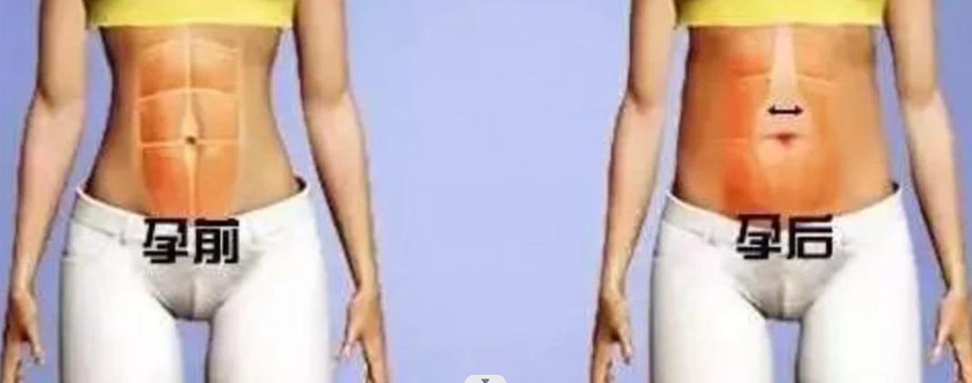 做了开腹手术怀孕了咋办,做完腹腔镜手术后发现怀孕了