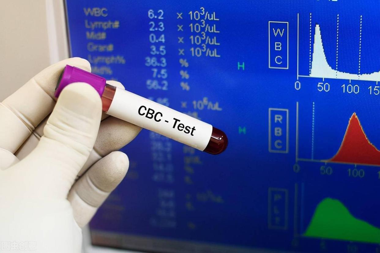 血常规最怕三种指标偏高一点点,血常规检查一些指标偏高一点点