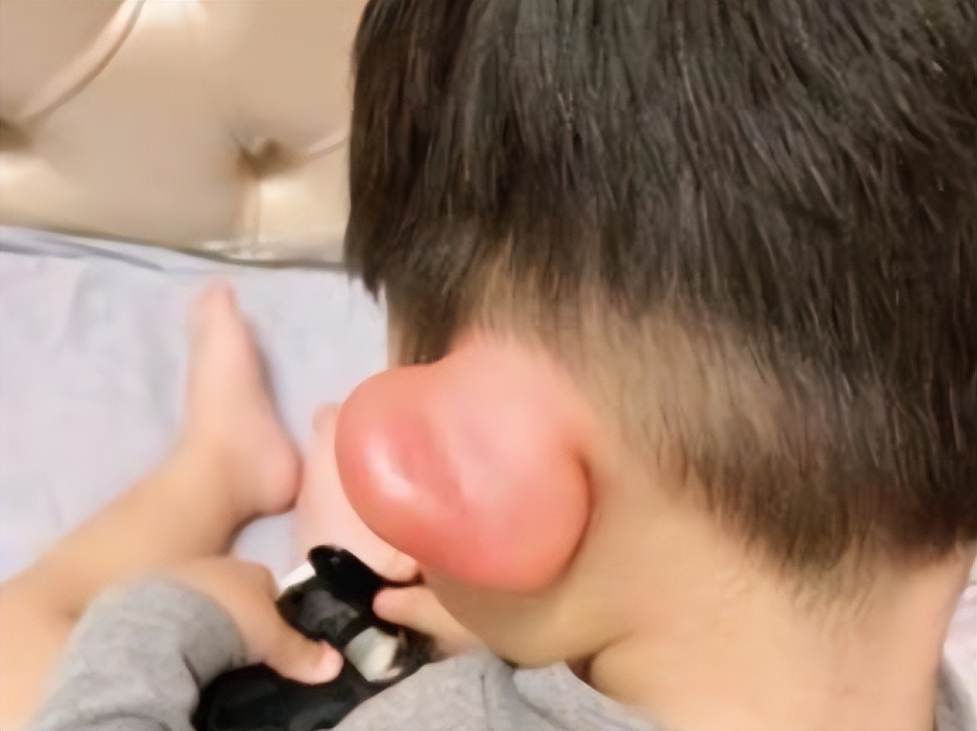 宝宝夏天很惹蚊子,宝宝被蚊子困扰