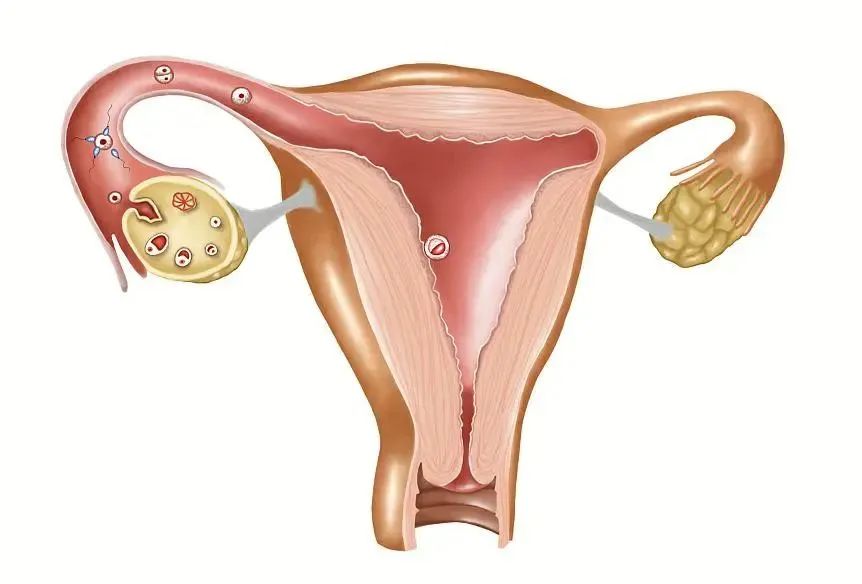 移植后胚胎发育缓慢怎么办,胚胎发育缓慢影响大脑吗