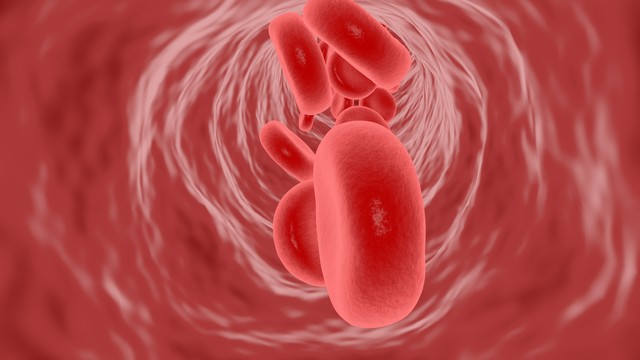 桥本甲状腺炎中医解释,中医对桥本氏甲状腺炎的认识