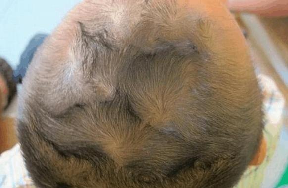 孩子头上的旋有什么含义,孩子头上的旋代表着什么