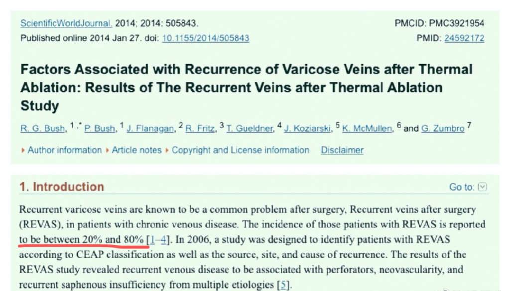 静脉曲张可以根治吗,静脉曲张能治好吗