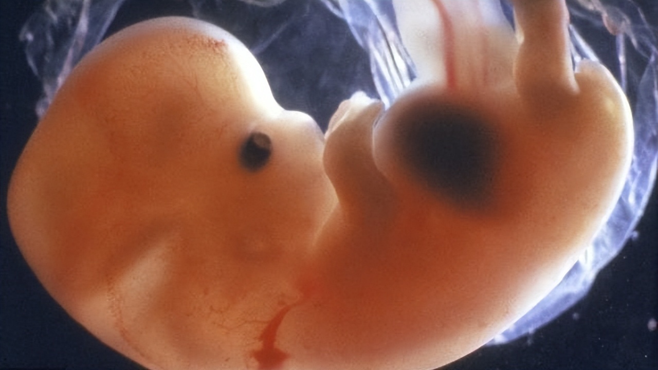 孩子颈部鼓起一个硬包图片,小孩颈部有鼓包颜色变重