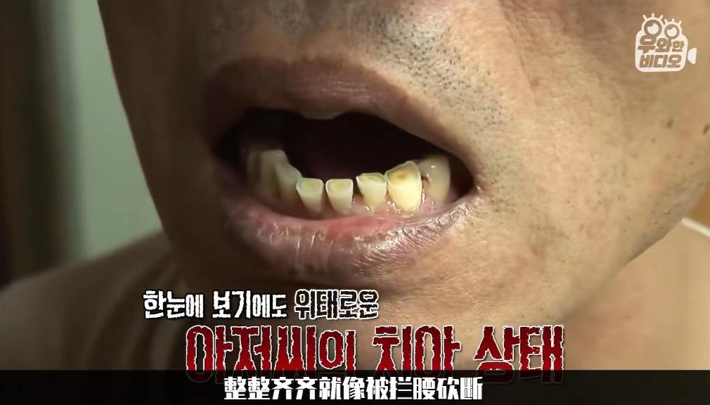 夜里睡觉磨牙解决小常识,每晚睡觉磨牙是什么原因怎么解决