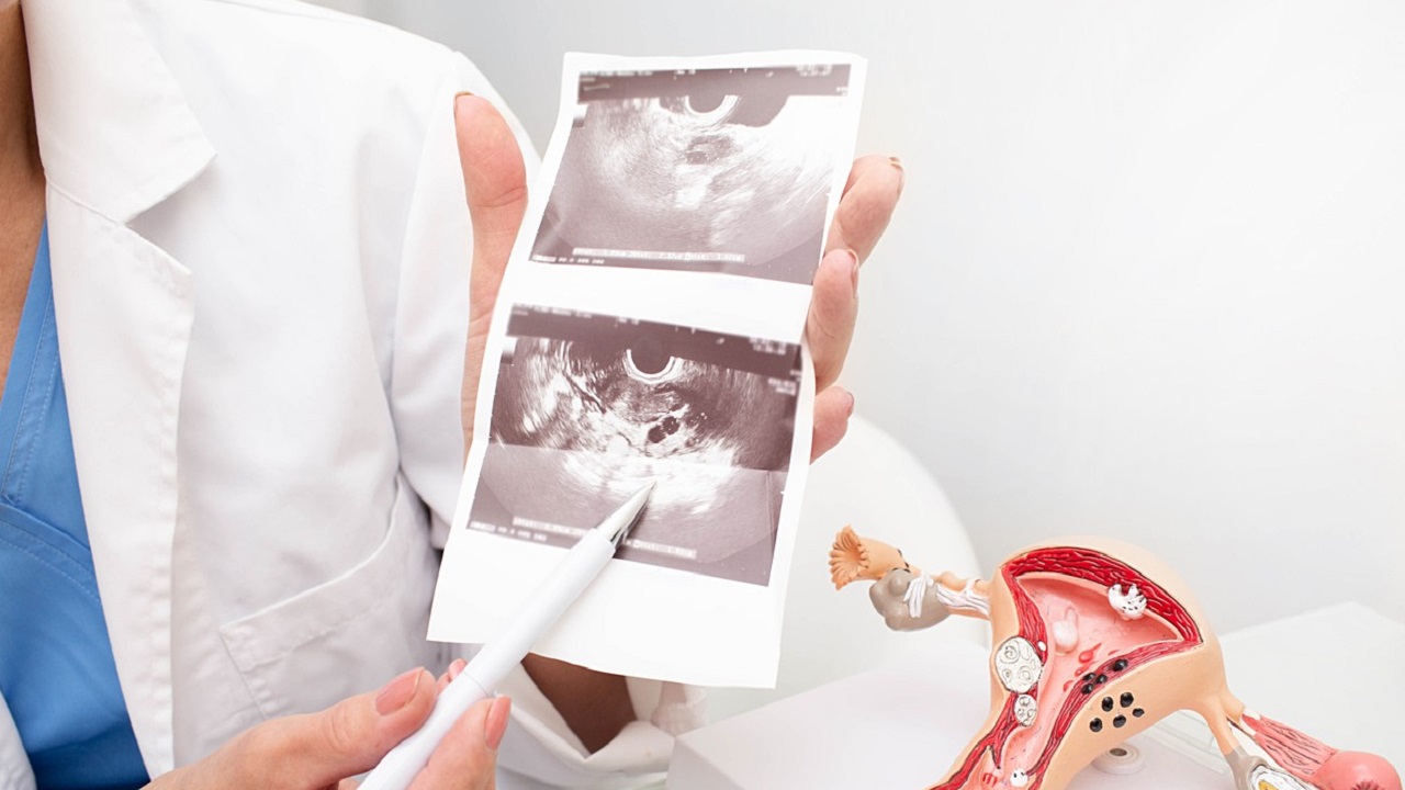 中国第一批“上环”的女性，医生直言：30年了，难逃出这4种结局