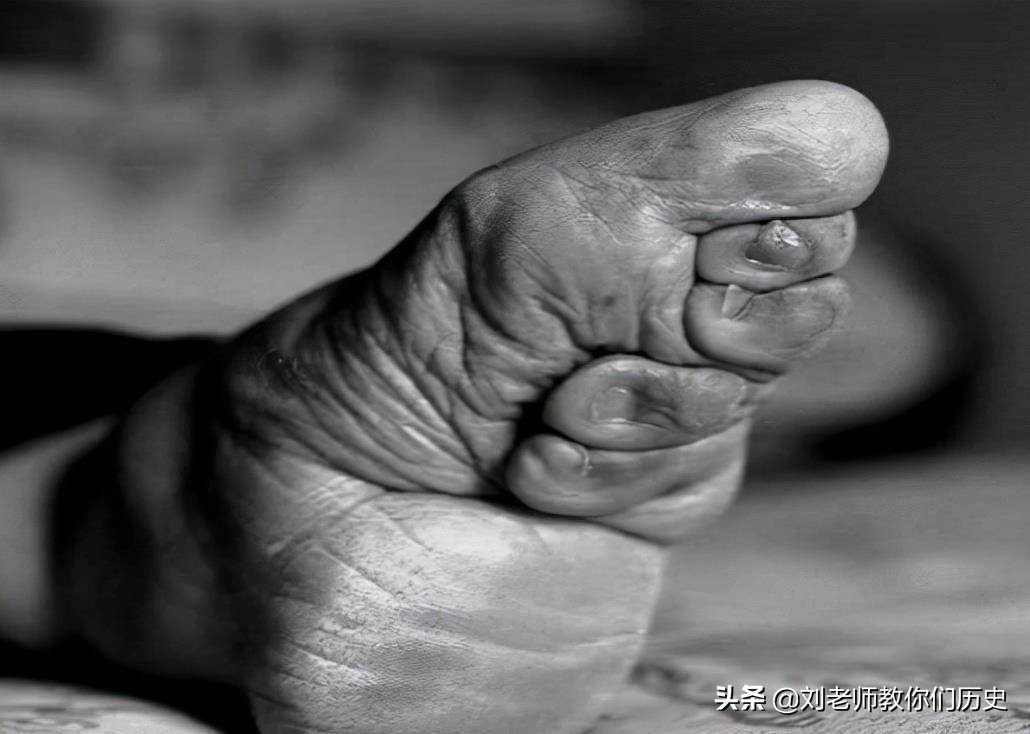 历史上什么朝代开始裹小脚,古代裹小脚的真实目的是什么