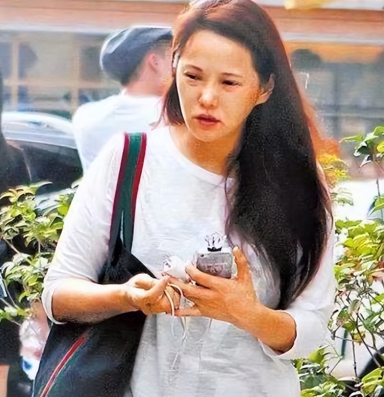 面部衰老皱纹解剖图,面部皱纹衰老对比图