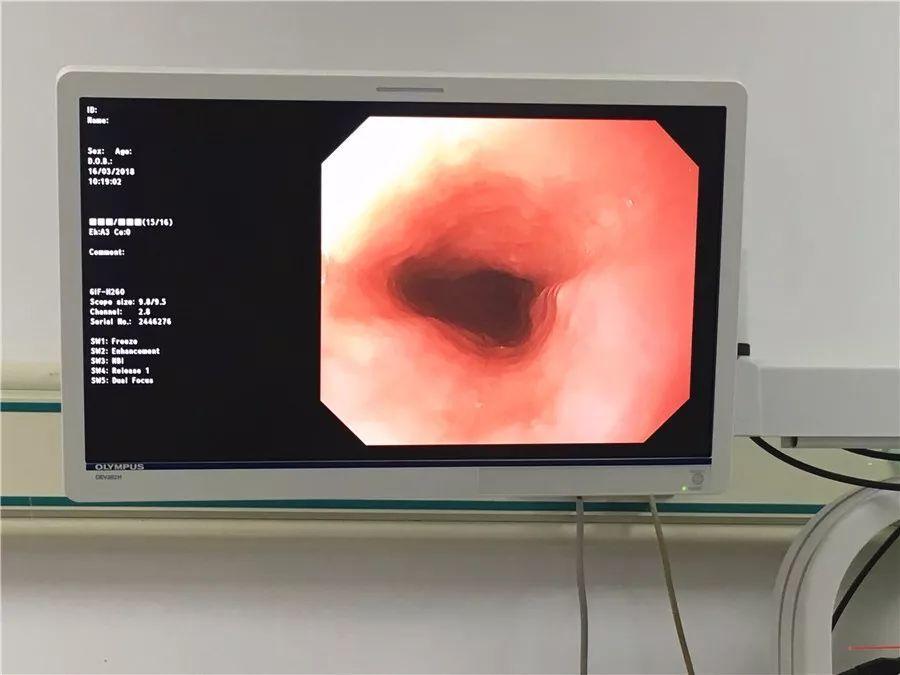 胃镜多久做一次合适正常人,胃镜多久做一次对身体没有危害