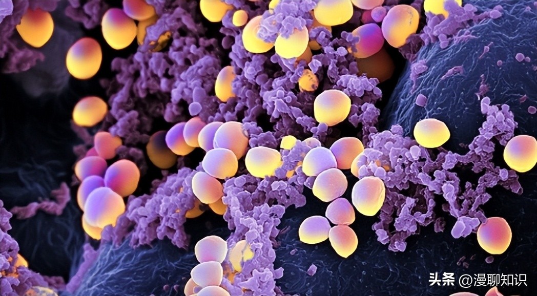 牦牛是高山地区牛的独特品种，肉质鲜嫩，但却饱受葡萄球菌的侵害