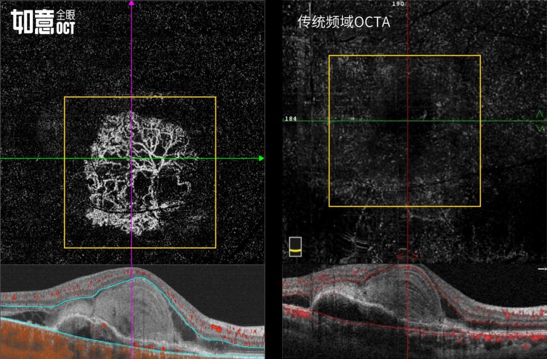 惠民眼科医院,惠民中心医院眼科