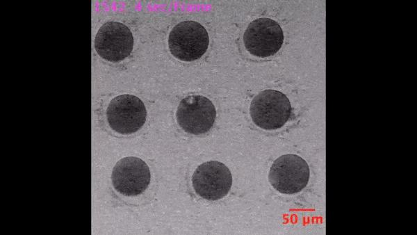 只有一个精子怎么会有双胞胎,只有一个精子正常能受孕吗