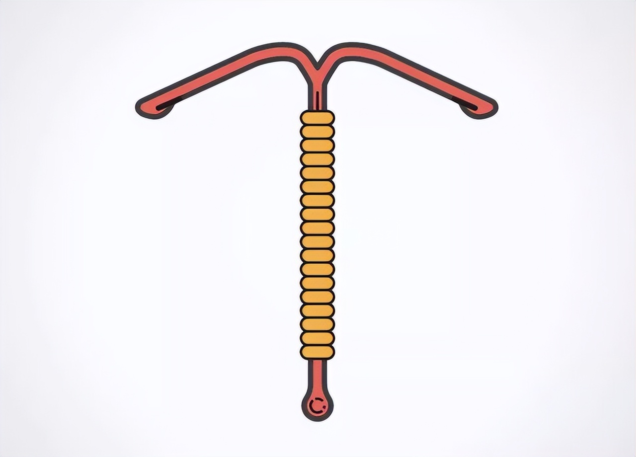 节育环不取出，会长到肉里吗？医生提醒：最佳取环年龄别超这个数