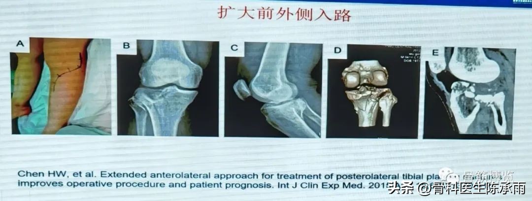 国家卫健委主办的骨创伤专项能力培训项目----下肢损伤学习班