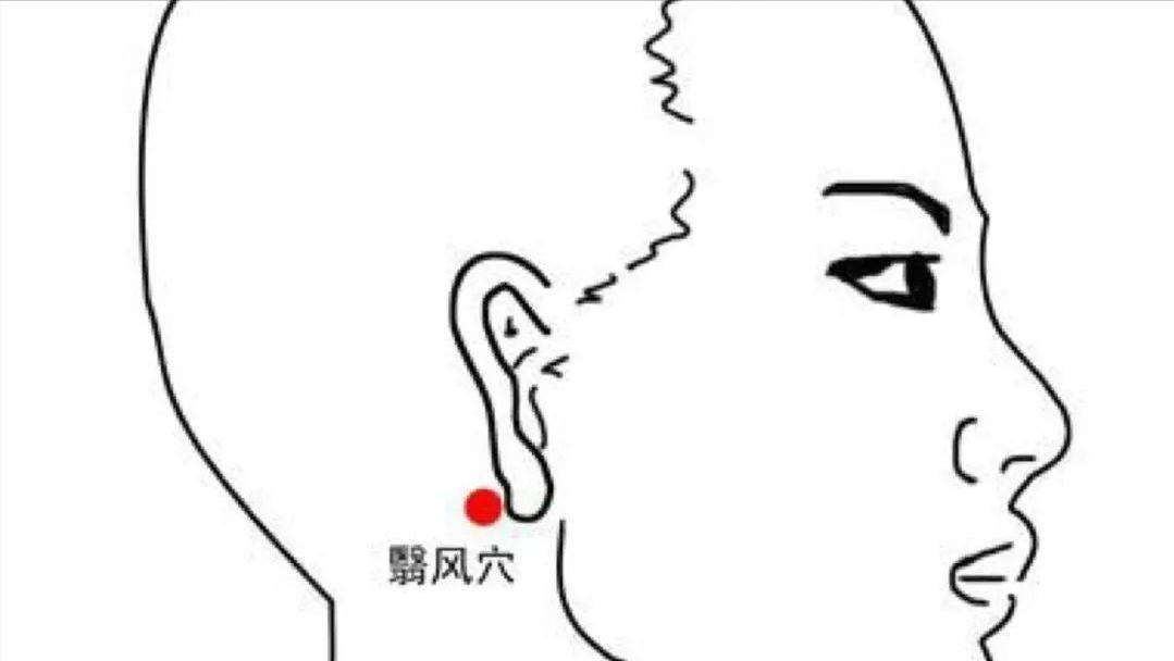 面瘫口眼歪斜怎么治疗最好,中风面瘫口眼歪斜怎么治