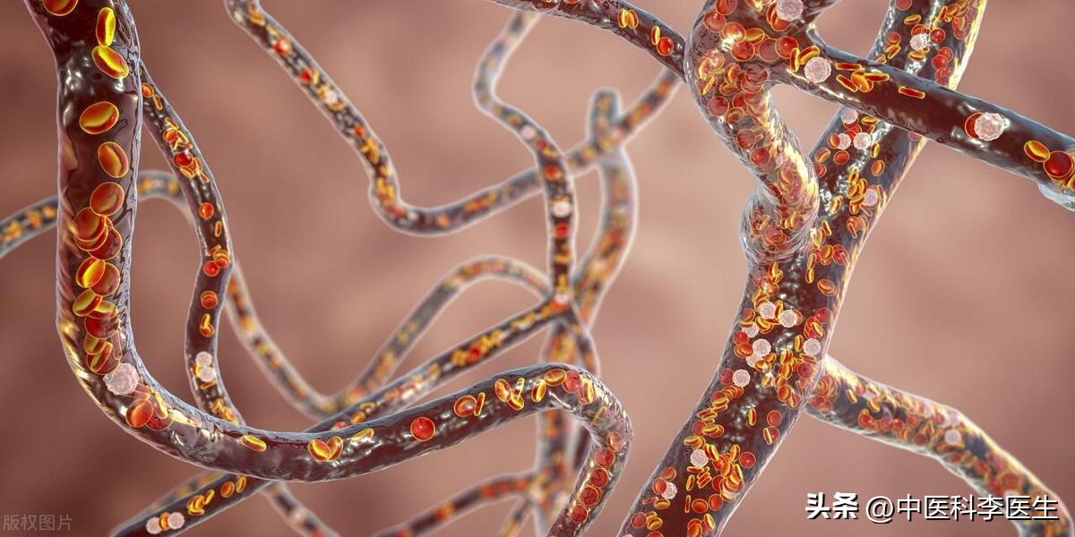 女人膝盖上的淤青怎么弄的,女人膝盖淤青