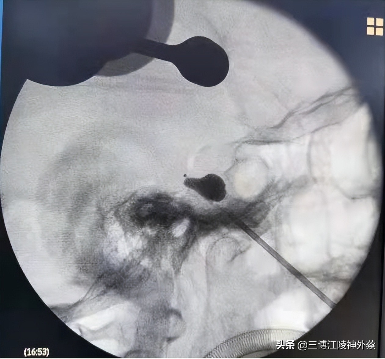 无缘无故面部疼痛怎么解决,面部有时感觉疼是什么原因