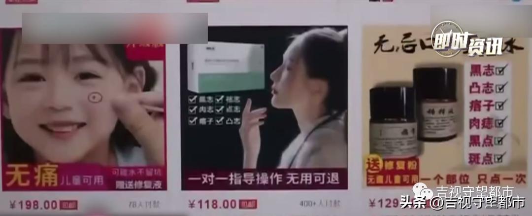 点痣药水祛痣的亲身经历,无痛点痣药水测评