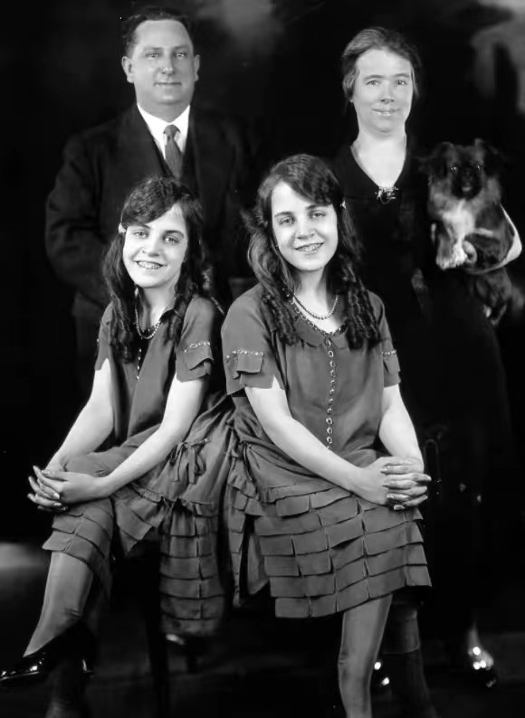 英国连体姐妹因流感去世,英国连体姐妹去世