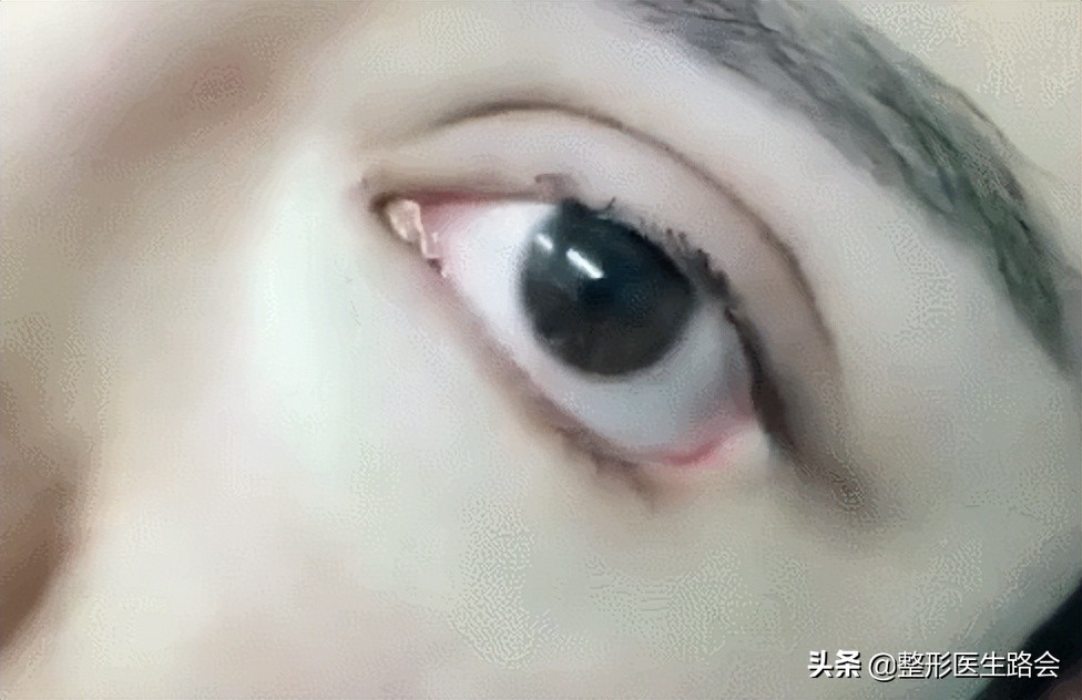 为什么医生不建议去三甲医院,三甲医院医生不建议做手术