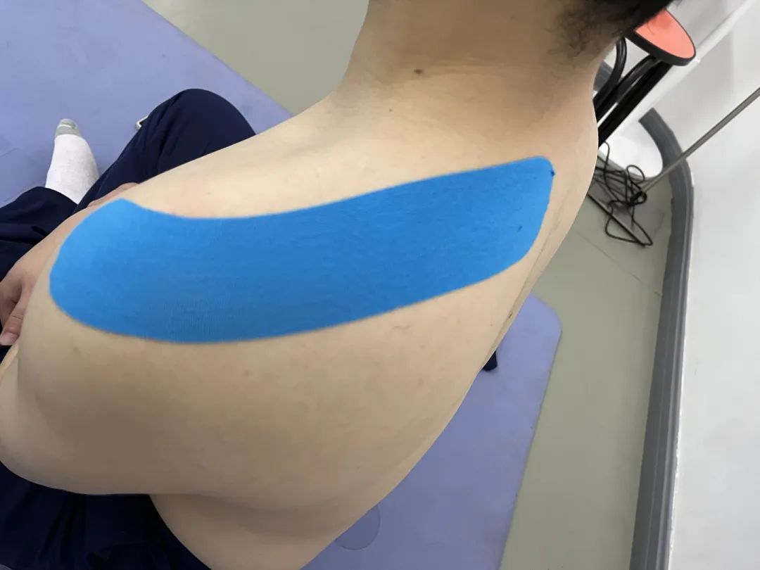 肌效贴颈椎使用方法图解,肩膀疼肌内效贴使用方法