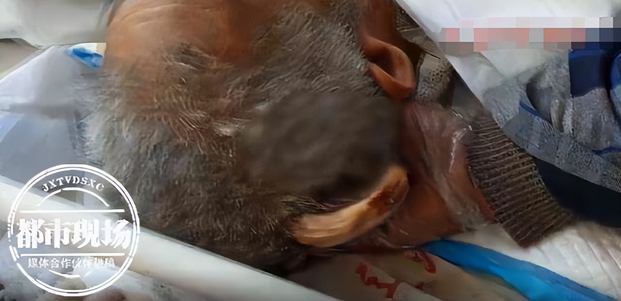 头上长角的长寿老人,107岁老人头上有个长犄角