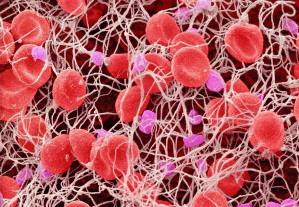 阿莫西林都是消炎药吗,阿莫西林是最好的消炎药了吗