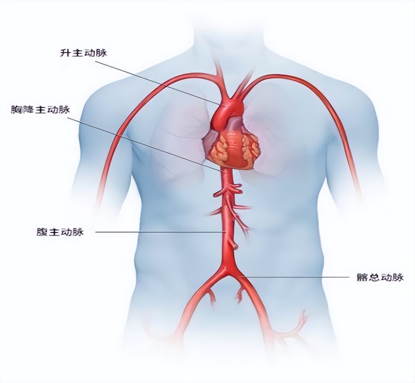 主动脉夹层高发是怎么回事,主动脉夹层怎么可以做到早期发现