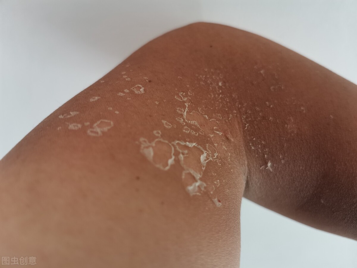 脸上长斑什么因果,8岁女孩遗传脸上开始有斑怎么办