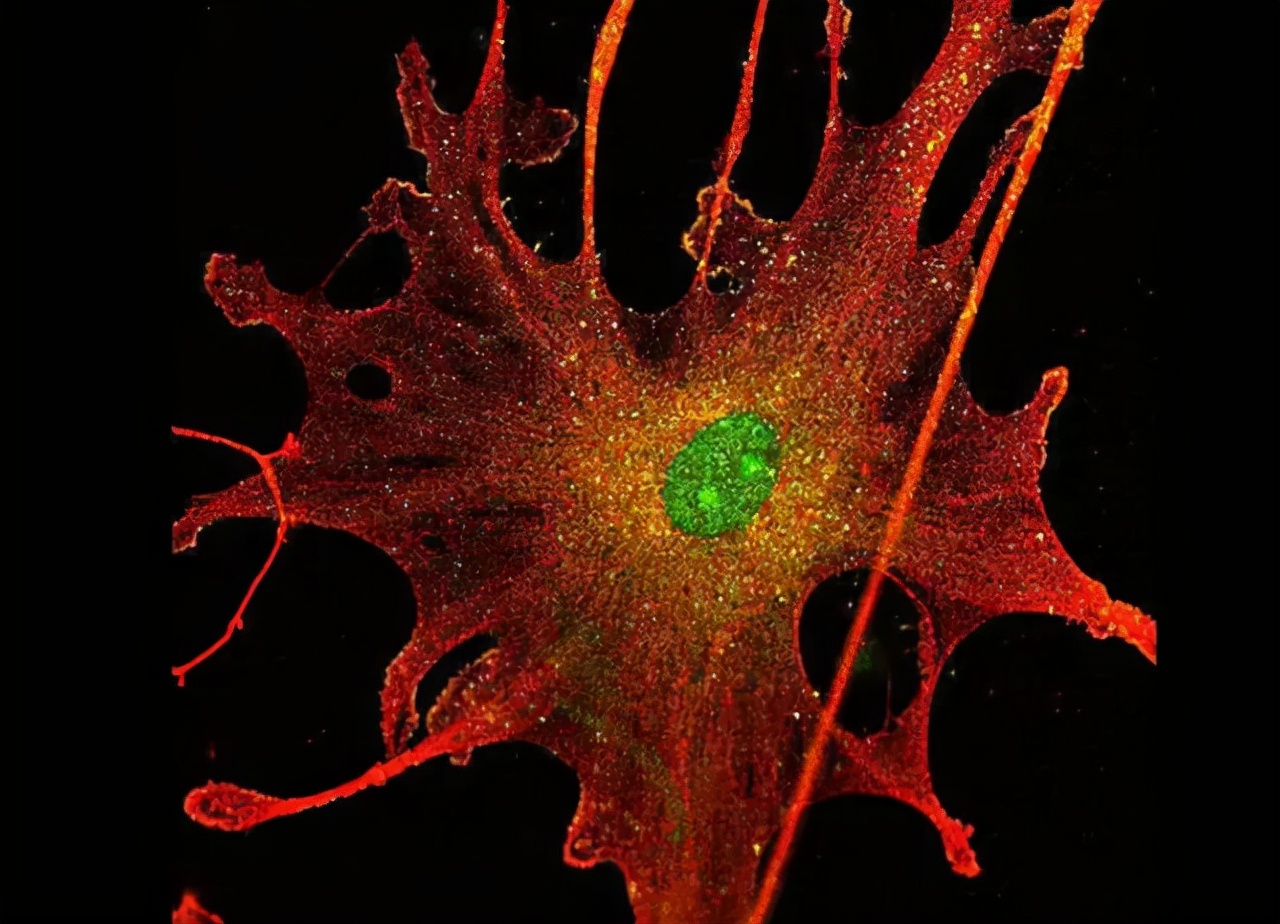 如果皮肤出现这些症状，及早做检查