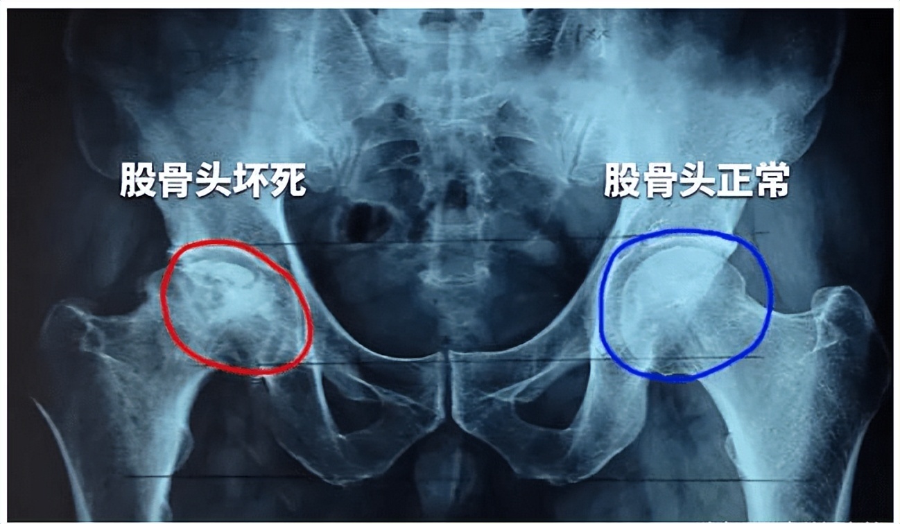 身体有哪些疾病会引起腿痛,身体有病情况说明
