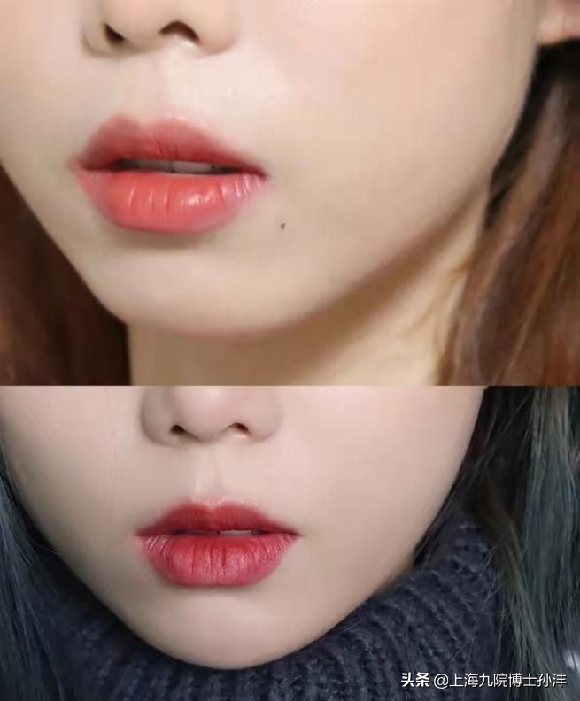 下巴对气质的影响,最好的下巴是双下巴吗