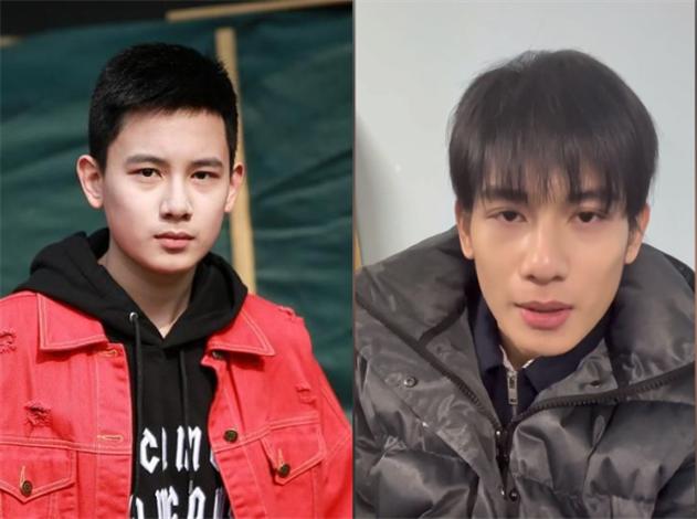 周星驰割双眼皮访谈,周星驰割双眼皮前的电影