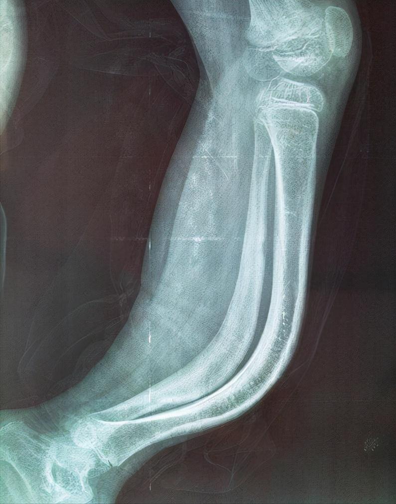 他身高不到1米，却能和1米7美娇妻生孩子，孩子到底是他的吗？