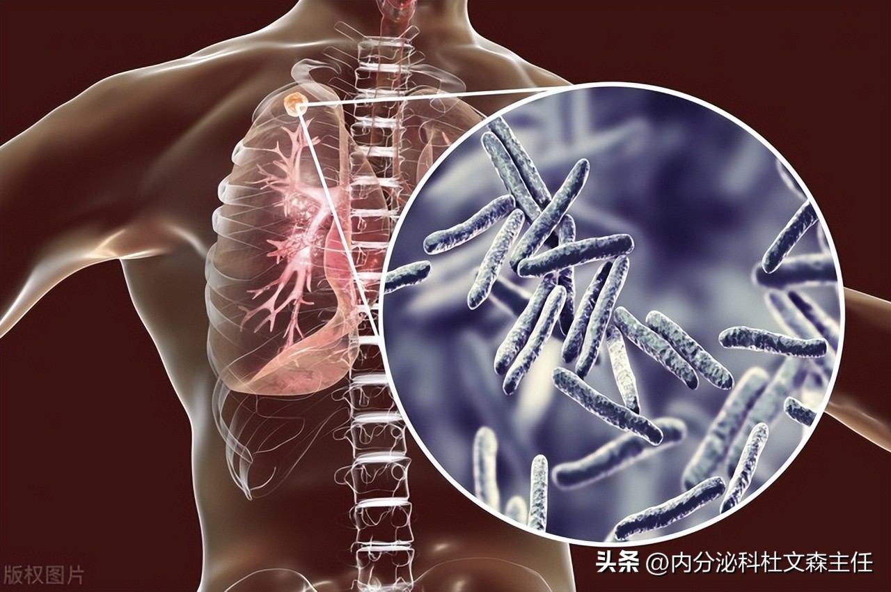 两味中药，摆脱乳腺结节囊肿！