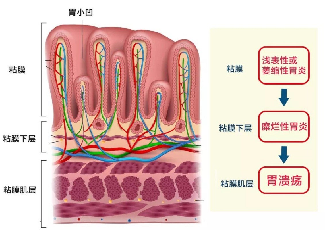 酸性越强氢离子越多吗,酸性越强非金属性越强吗