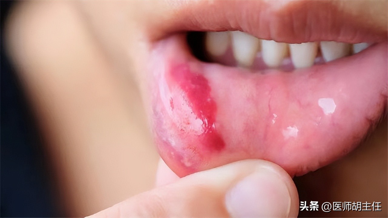 一瓶维生素b2仅要几块钱,补充几块钱一瓶的维生素b12管用吗