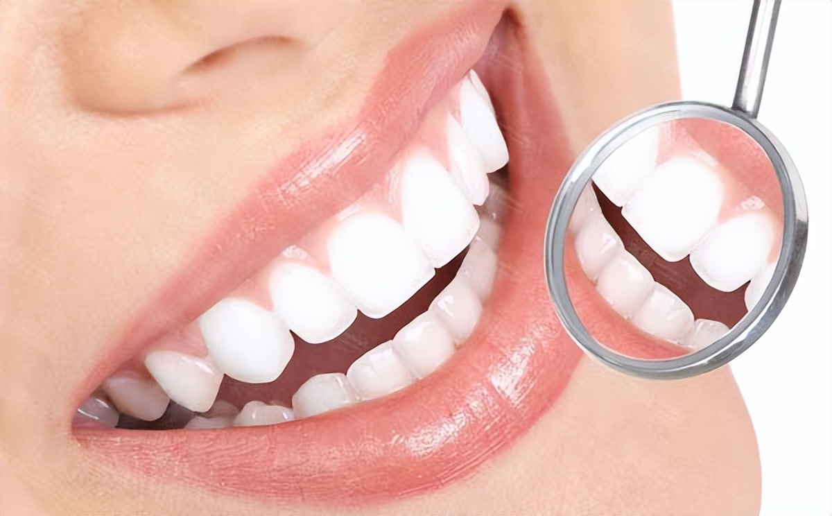 牙齿美白真相大揭秘,牙齿黄怎么美白