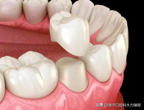 一颗牙得花多少钱,看一次牙