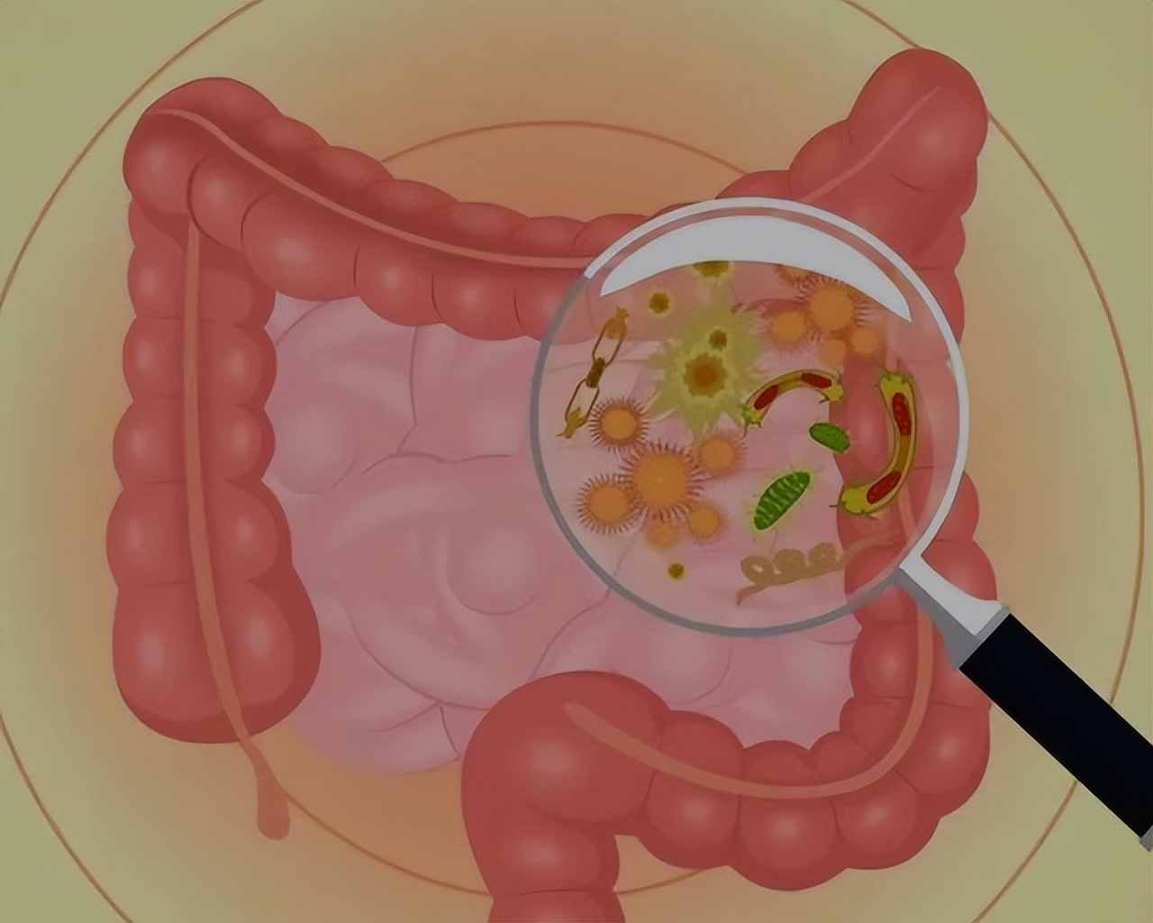 什么叫宿便肠道中的粪便,人体有几斤宿便